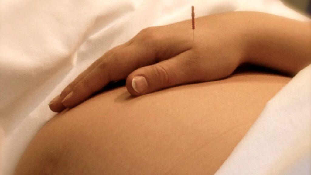 How Acupuncture Can Benefit You While Pregnant (1)